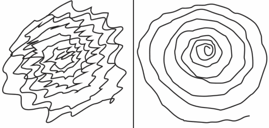 Tremor Essencial Espiral de Arquimedes